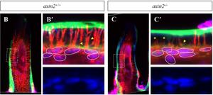 Axin2 deletion interrupts odontoblast differentiation