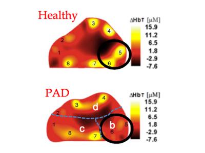 New Vascular Optical Tomographic Imaging System