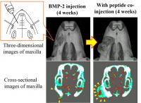BIOLOGICAL BONE AUGUMENTATION コンセプトに則りKHOURY
