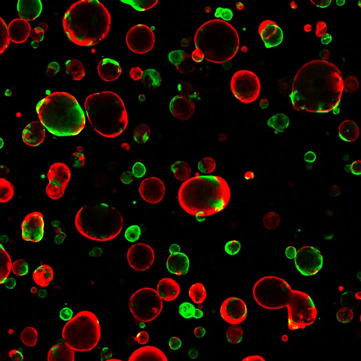 A Project to Generate 1000 Organoid-based Models of Cancer
