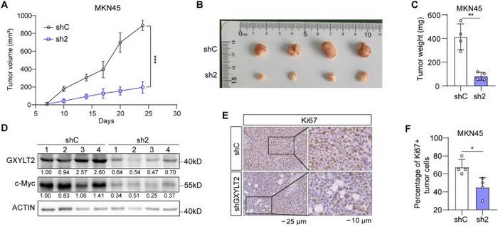 GXYLT2 inhibited the tumorigenicity of GC cells.