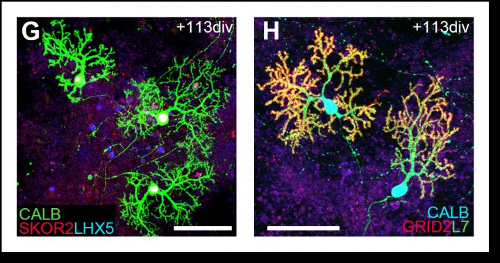 Examples of Mature Purkinje Cells Grown from Human Embryonic Stem Cells