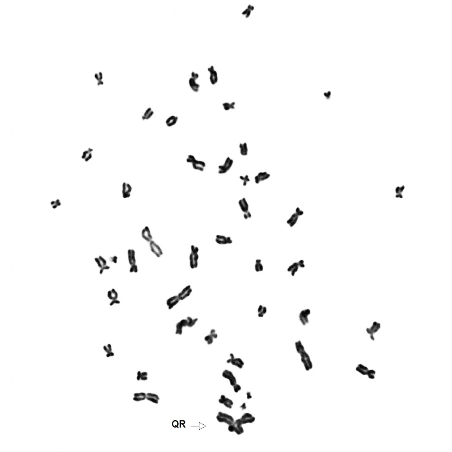 Karyotype of HAP1 Cells Lacking FANCC Gene