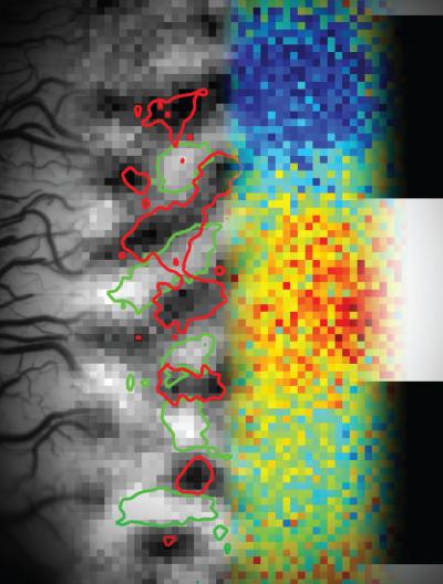Multiplexing in the Visual Brain