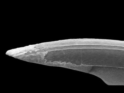 Lower Incisor