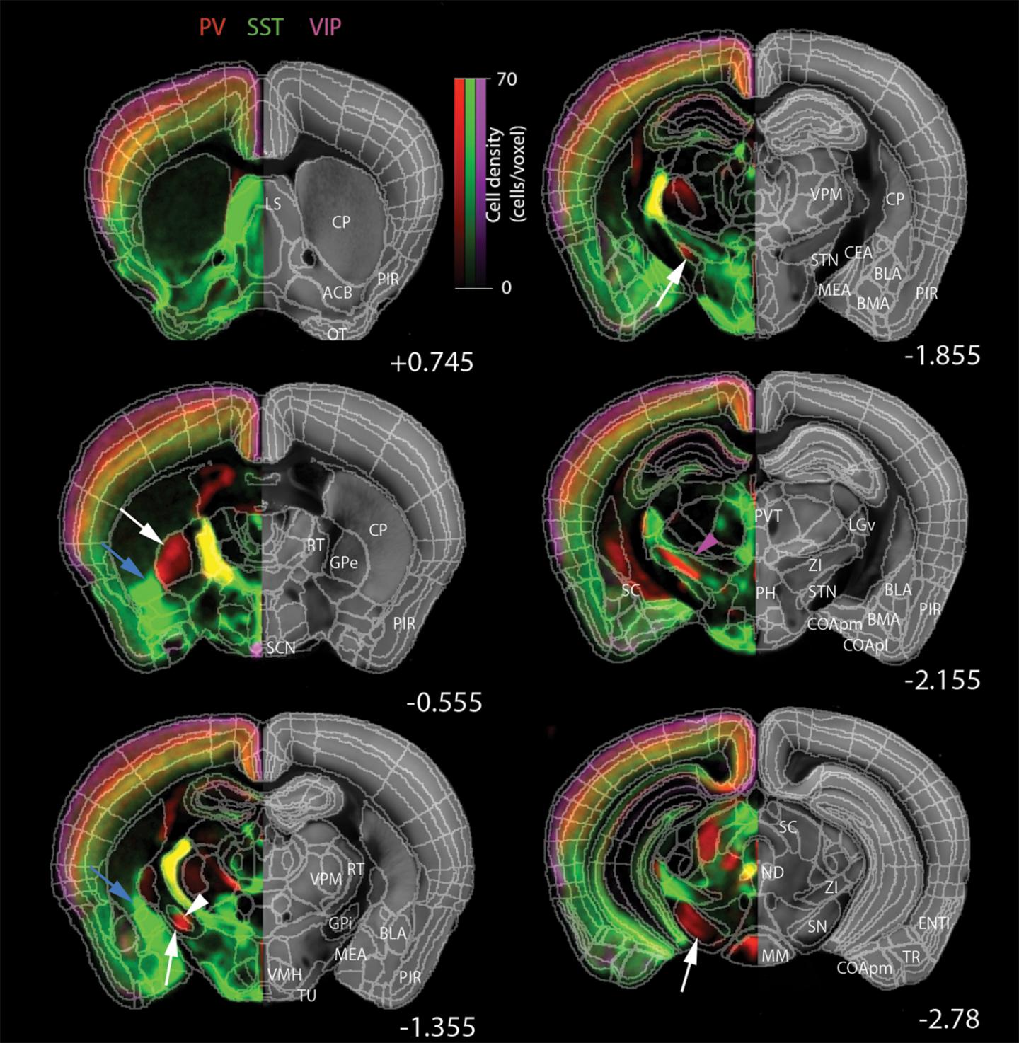 Images Revealing Male-Female Brain Cell Differences