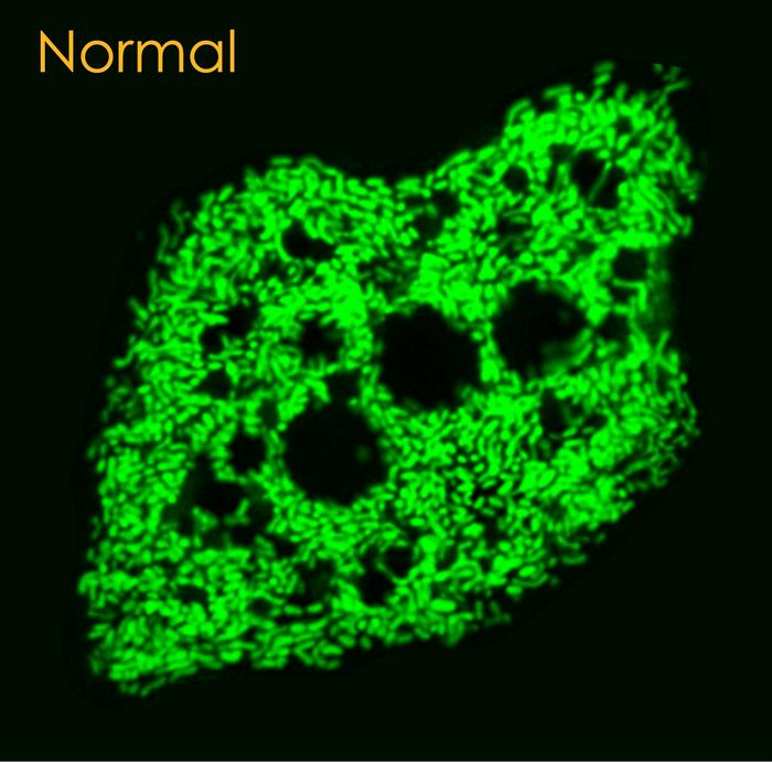 Normal mitochondria