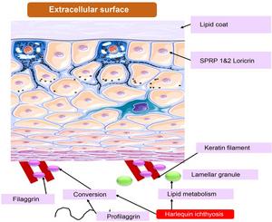 The pathophysiology of genetic ichthyoses includes the composition of the cellular surface region of cornified cells