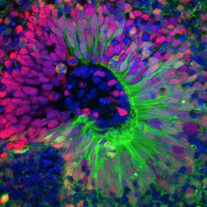 Brain organoid