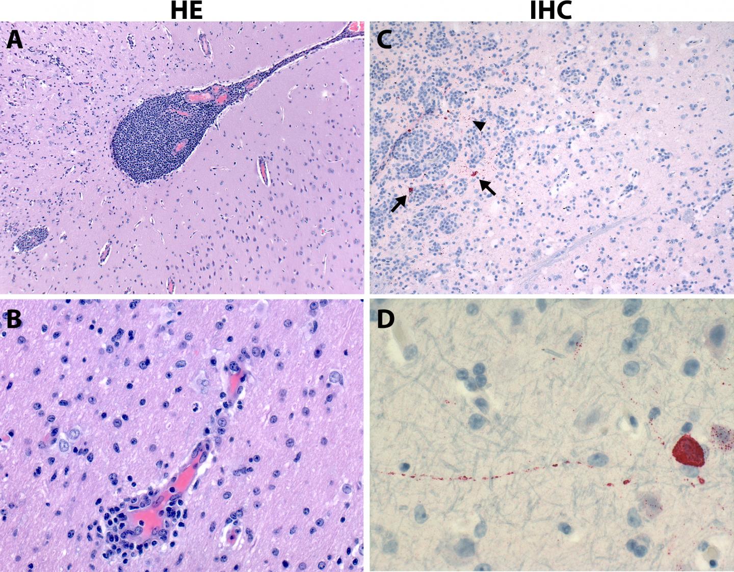 Experimental Antiviral for Ebola Protects Animals from Nipah Virus (1 of 2)
