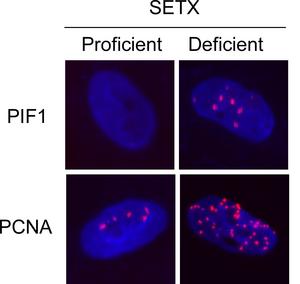 Scientists find cancer weak spot in backup DNA repair system