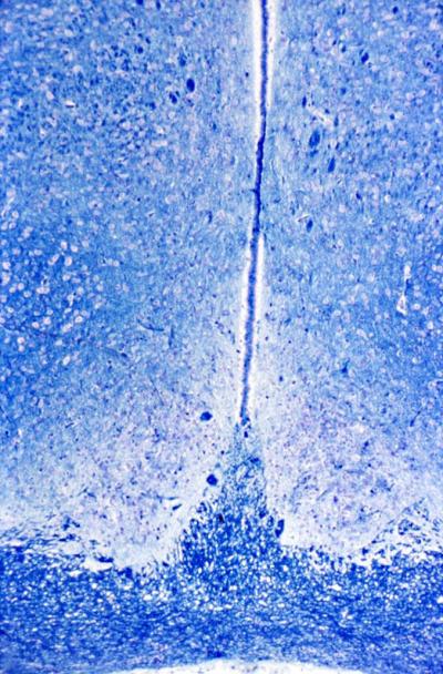 Vasopressin Hormone Linked to Jet Lag