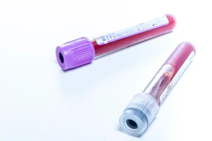The liquid biopsy is a blood test that detects signs of cancerous tumors.