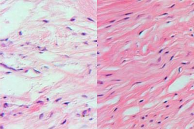 Tissue Comparison