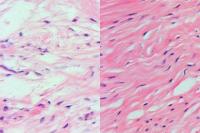 Tissue Comparison