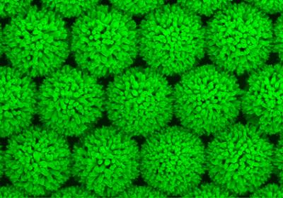 'Sea Urchin' Structures