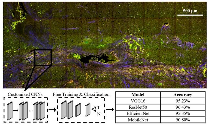 Label-free multiphoton microscopy and deep learning can be used in combination to classify pancreatic neuroendocrine neoplasms with high accuracy—a significant step toward automated digital pathology for such tumors.