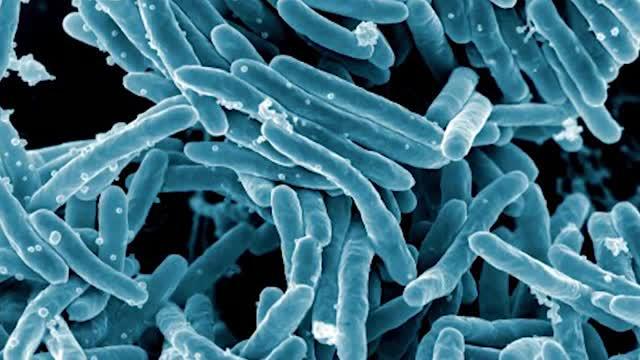 Help Stop TB project