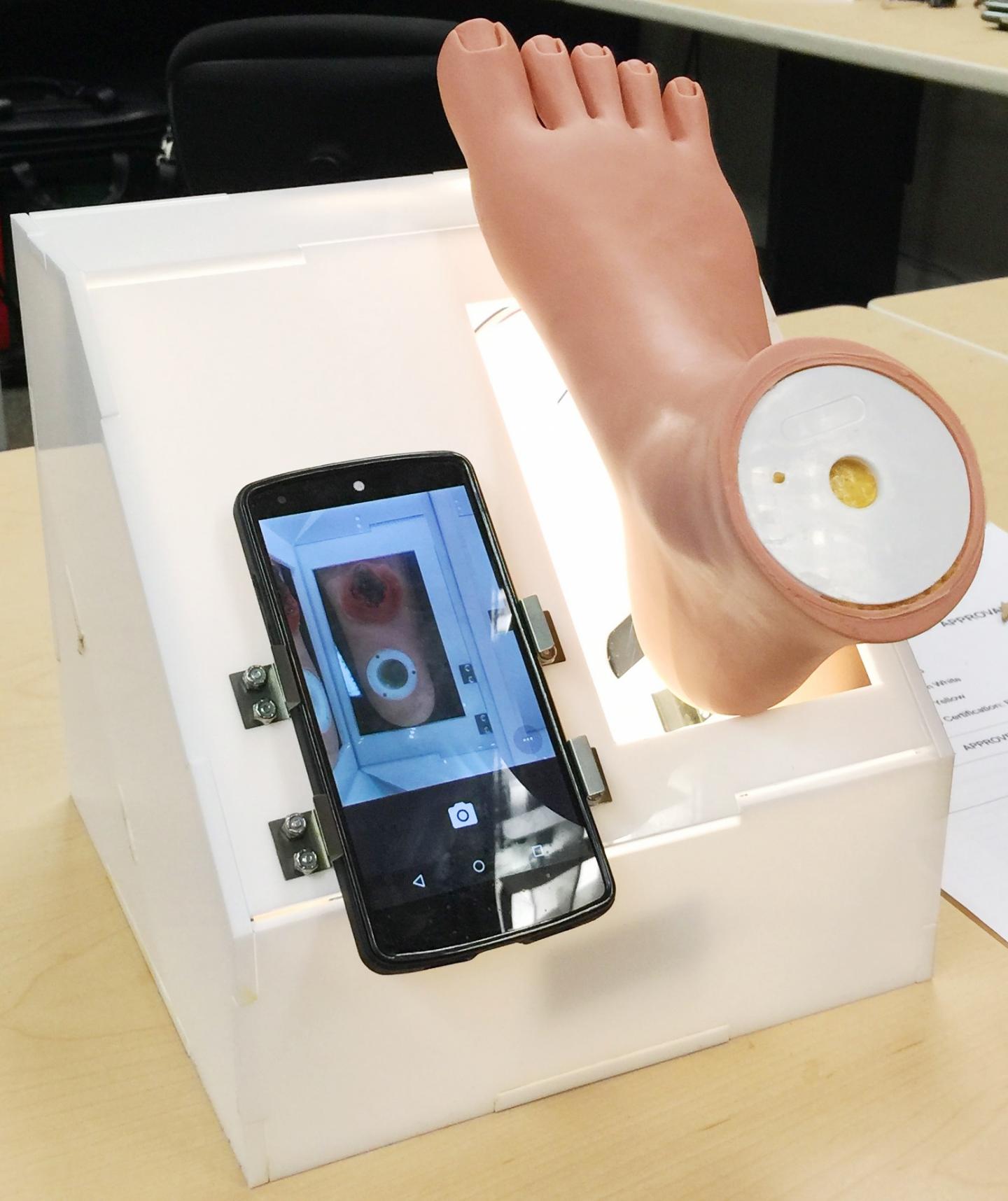 Box for Recording Chronic Foot Ulcers