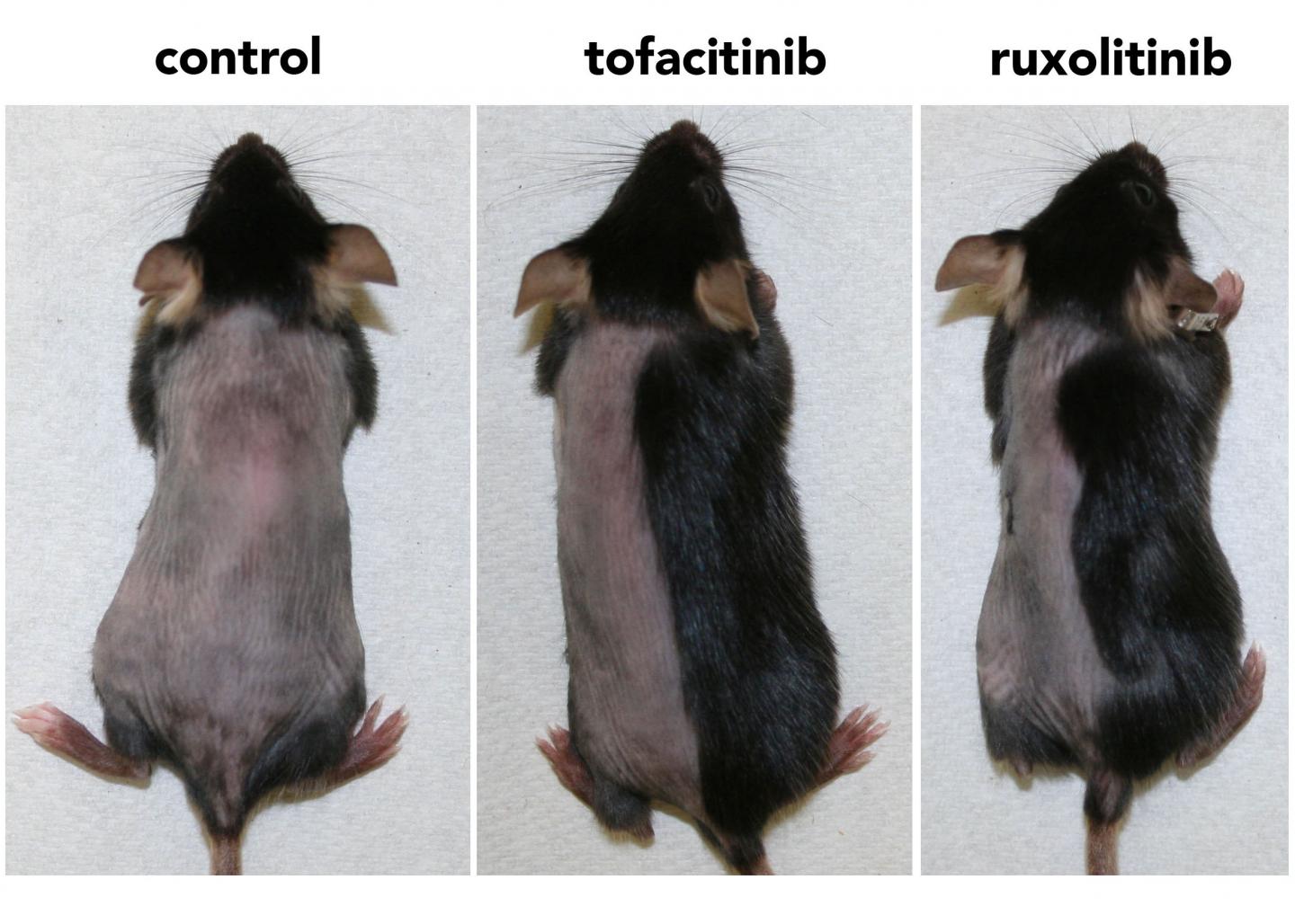 Blocking Enzymes in Hair Follicles Promotes Hair Growth