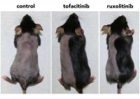 Blocking Enzymes in Hair Follicles Promotes Hair Growth