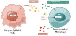 PRRX2+ epithelial/SPP1+ macrophage crosstalk drives EMT and microenvironment remodeling in gemcitabine-resistant PDAC