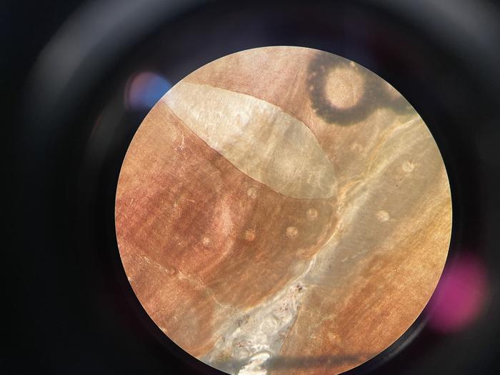 Parasites in mussel