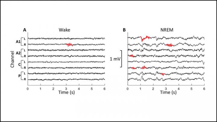 Sleeping Sheep Maay Offer Clues to Human Brain Disease