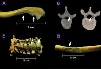 Joint and Bone Damage