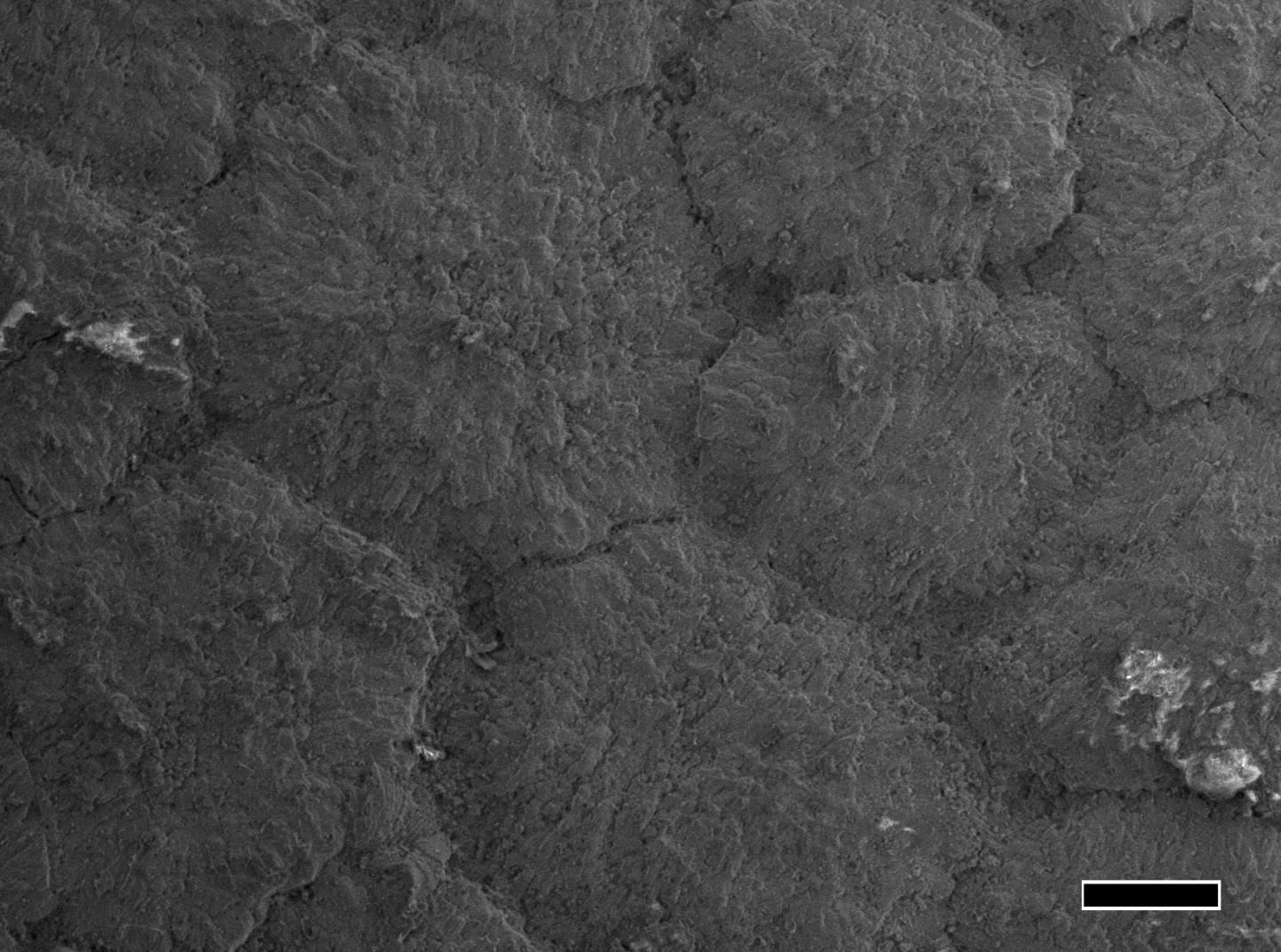 <i>Platylithophycus</i> SEM