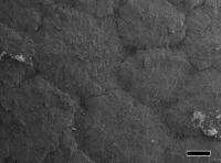 <i>Platylithophycus</i> SEM