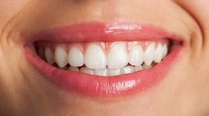 Arginine reduces and destabilizes bacterial plaques which cause tooth caries