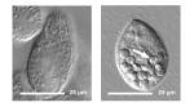 Quantum Dot-Tainted Bacteria Stop Digestion in the Protozoan