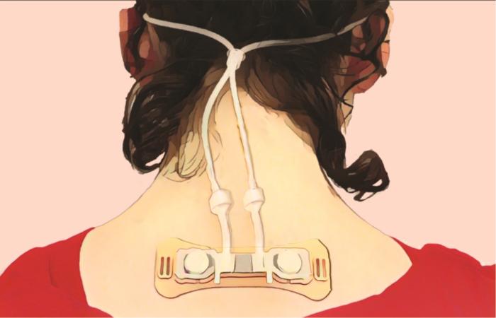 View of device on nape of neck
