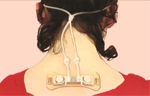 View of device on nape of neck