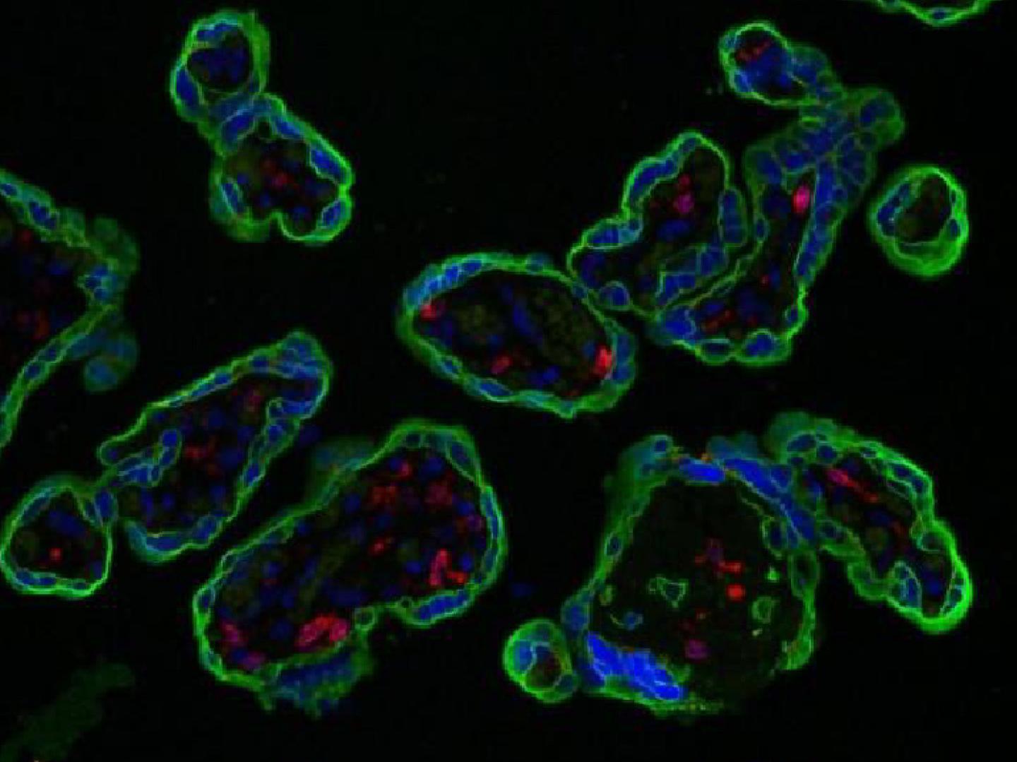 CD74 in the Placenta
