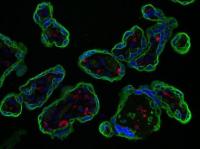 CD74 in the Placenta