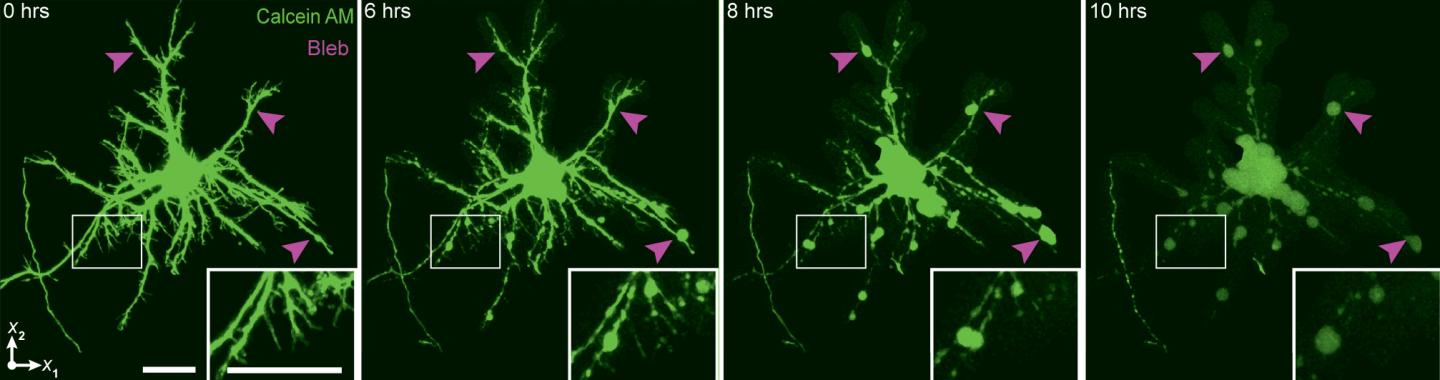 Neuron Damage
