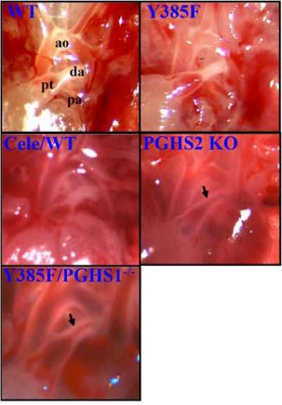 Pick Your COX Partners