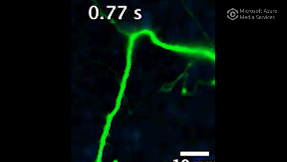 DopaFilm detection of spontaneous activity from a dendritic process