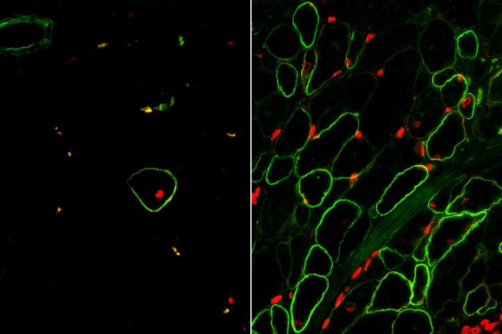 Skeletal Muscle Cells