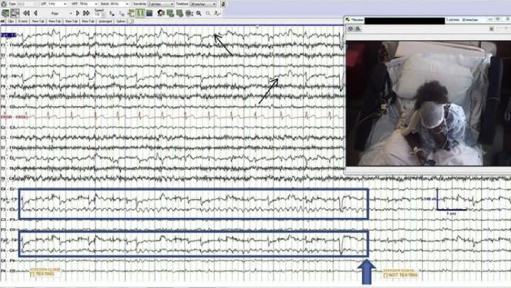 Text Messaging with Smartphones Triggers a New Type of Brain Rhythm