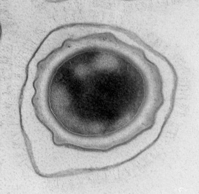 Bacillus anthracis