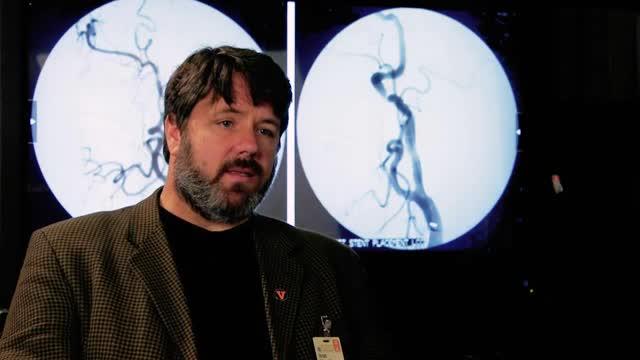 Sweeping Review of Human Genome IDs Stroke Risk Genes