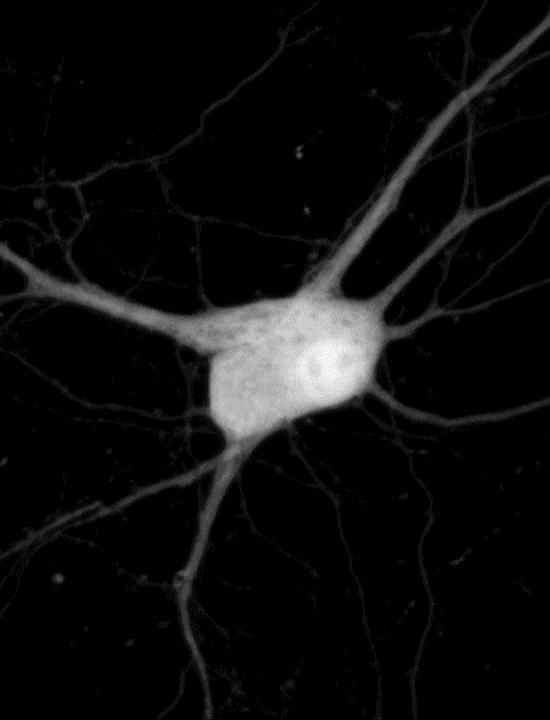 Neuron