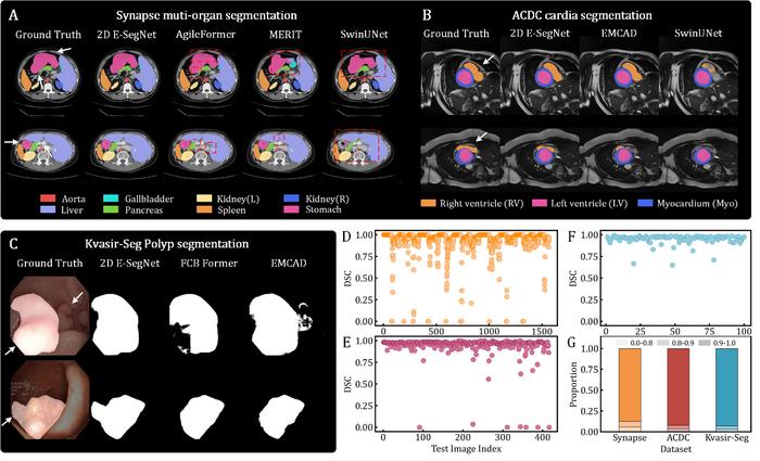 Figure 2. Performance on 2D medical image segmentation tasks