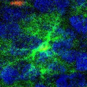 Mouse astrocyte and neuron in color