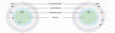 CATSPER1 Gene and Male Infertility