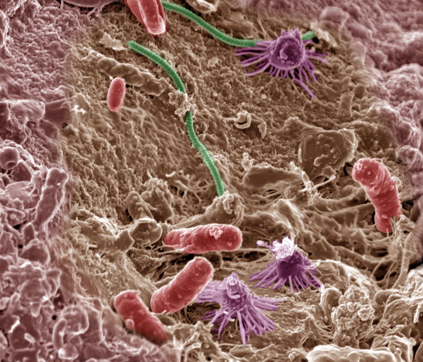 Soil Microbes