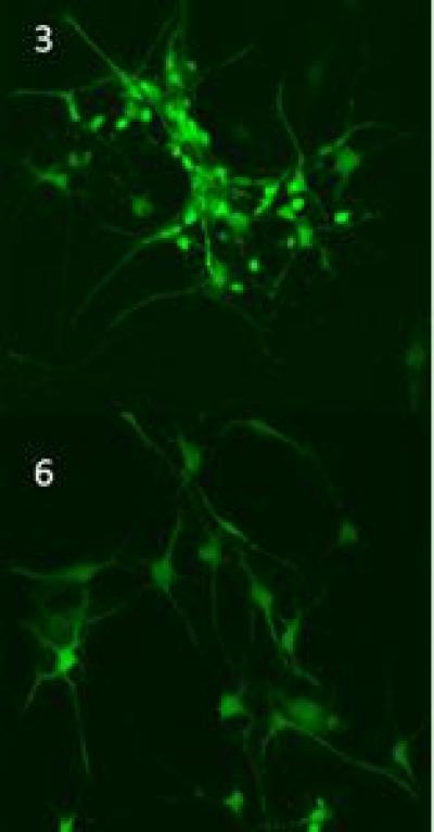 Fibrillar Amyloid-Beta 40